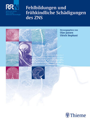 cover image of Fehlbildungen und frühkindliche Schädigungen des ZNS